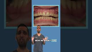 How can composite bonding improve your smile oralhealth smilemakeover teethcare dentist dental [upl. by Charmaine]