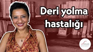 Deri yolma hastalığı [upl. by Nanerb471]