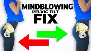 The Mindblowing Best Fix For Anterior Pelvic Tilt instant results [upl. by Hjerpe]