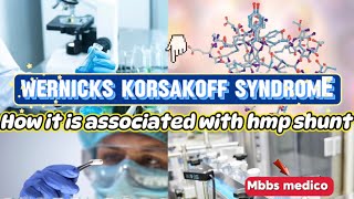 Wernicke korsakoff syndrome and how it is associated with hmp shunt hmp shunt disorders [upl. by Lauhsoj]