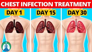 7 Natural Chest Infection Treatments Home Remedies [upl. by Attolrac]