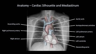 How to Interpret a Chest XRay Lesson 2  A Systematic Method and Anatomy [upl. by Jankell]