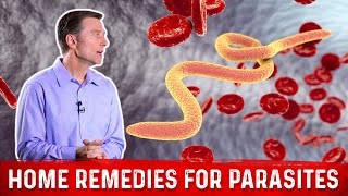 Best Home Remedies for Parasites – Dr Berg [upl. by Pebrook]