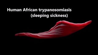 Human African Trypanosomiasis sleepingsickness Trypanosomiasis WHO [upl. by Finnegan]