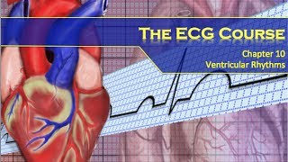 The ECG Course  Ventricular Rhythms [upl. by Yrollam]