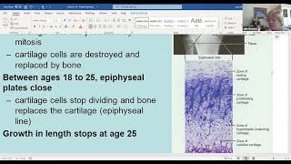 Day 12 June 19 Endochondral Ossification [upl. by Creigh]