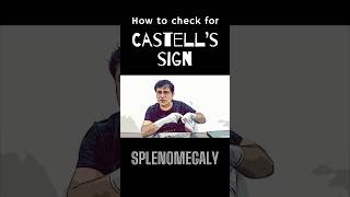 What is Castell’s sign in splenomegaly shorts splenomegaly spleenanatomy [upl. by Anayk907]