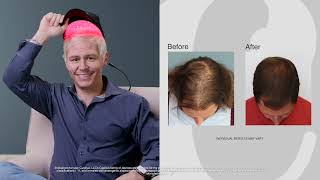 Hair loss no more real men real results with Capillus [upl. by Alarice470]