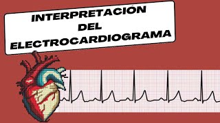 Interpretación del Electrocardiograma [upl. by Ion]