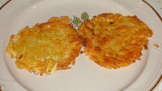 Crispy Restaurant Style Hash Browns Recipe [upl. by Fifi]