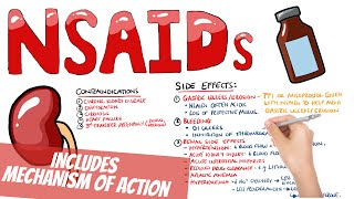 Non Steroidal AntiInflammatory Drugs NSAIDs Pharmacology  What do NSAIDs do How do NSAIDs work [upl. by Niran]