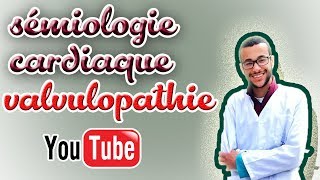 sémiologie cardiaque valvulopathie gauche [upl. by Ganny]