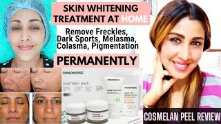 💯Permanent Whiter Skin at home Cosmelan Peel Review Before and After Cosmelan Treatment Lighten Skin [upl. by Aurilia]