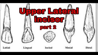 Upper lateral incisor quot part 2 quot [upl. by Farrington]