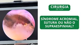 Síndrome Acromial sutura ou não o Supraespinhal  281024 [upl. by Nedloh]