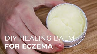 Tutorial for making a Natural Healing Cream for Eczema and Psoriasis [upl. by Tiebold]