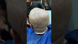 HeadShave before head tumor surgery part1 👩🏻‍🦲😢😱😭please pray for this man 👨 [upl. by Brighton]