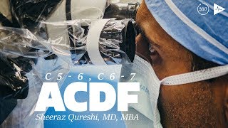 C56 C67 Anterior Cervical Discectomy and Fusion  Case Trailer [upl. by Burkhardt]