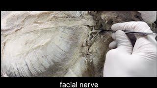 Facial nerve anatomy [upl. by Nenerb]