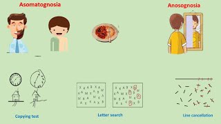 hemineglect syndrome  hemispatial neglect [upl. by Eisen]