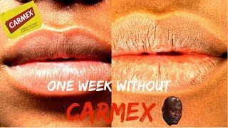 One Week Without CARMEX [upl. by Acisey673]