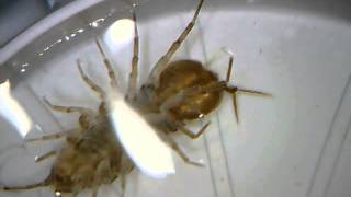 microscope video of asellus aquaticus waterlouse aquatic sowbug  Wasserassel unterm Mikroskop [upl. by Newcomb]