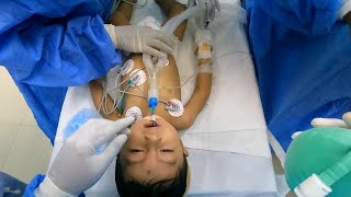 Pediatric Anesthesia Intubation Lessons  Anesthesiologist POV [upl. by Winer]