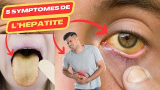 5 symptômes de lhépatite  hépatite virale c  hépatite virale b  hepatite a  hépatite [upl. by Eseuqcaj]