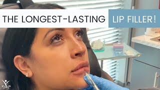 Volbella Lip Injections Can Last Up to a Whole Year [upl. by Denise52]