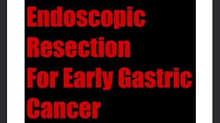 Endoscopic Resection of Early Gastric Cancer [upl. by Past444]