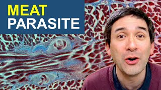 Why I would not eat this meat  Parasite Worms in meat under the microscope [upl. by Ahseele]