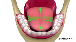 Denture StablizersHow To Keep Lower Dentures In Place [upl. by Nnel70]