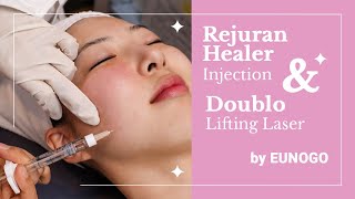 Rejuran Healer Injection and Doublo Lifting Laser  How Its Like  Before amp After  Eunogo Beauty [upl. by Yaniv]