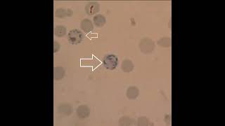 Reticulocytes cells immature red blood cells [upl. by Ttenrag]