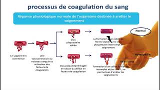 Hemato 10Coagulation  Hémophilie Dr Abbadi [upl. by Mloclam817]