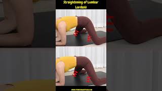 Straightening of Lumbar Lordosis  Lumbar Lordosis Solutions  Say Goodbye to Lumbar Lordosis [upl. by Porter]