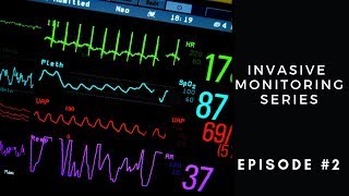 Invasive Monitoring Series Episode 2 Interpreting CVP and Art Lines with Cardiac Dysfunction [upl. by Yeltsew88]