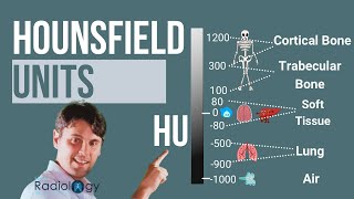 Hounsfield Units Where do CT numbers come from [upl. by Harper]