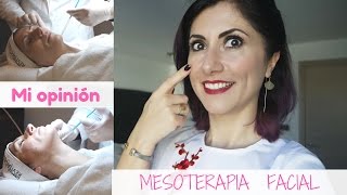 Mesoterapia Facial  Mi experiencia [upl. by Dnalyar940]