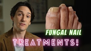 Fungal Nail Treatments [upl. by Upton]