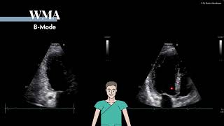 〖Echocardiography〗 Introduction to the right ventricle 💘 [upl. by Nueovas]