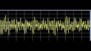 Infections  Rife Frequencies [upl. by Arraes869]