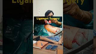 Ligament Surgery kis age group ko jyada jarurat hoti hai dailytips health doctor viralvideo [upl. by Felizio]