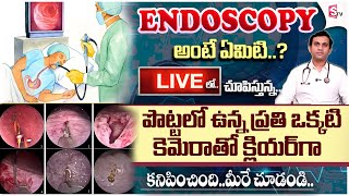 కడుపులో సమస్యలు  Know About Colonoscopy And Endoscopy  Gleneagles Hospital  DrGSSameer Kumar [upl. by Godbeare111]