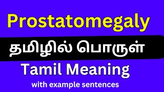 Prostatomegaly meaning in TamilProstatomegaly தமிழில் பொருள் [upl. by Drof]