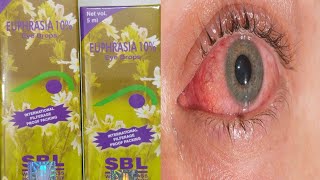 EUPHRASIA EYE DROPS  यूफ्रेसिया आंख का ड्रॉप हिंदी में  EUPHRASIA EYE DROPS IN HINDI [upl. by Arymat]