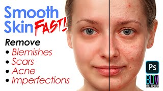 Photoshop Remove Blemishes Scars Acne amp Other SKIN Imperfections in PHOTOS [upl. by Brote]