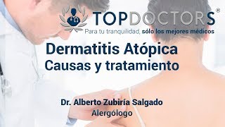 Dermatitis atópica Descubre sus causas y tratamiento [upl. by Nylek]