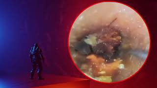 The Truth About earwax Will Shock You How to remove earwax from ear earwax extractions [upl. by Notac]