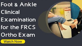 Foot amp Ankle Clinical Examination for the FRCS Ortho Exam  Orthopaedic Academy [upl. by Norvan89]